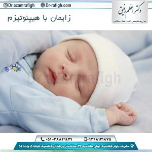 زایمان با هیپنوتیزم